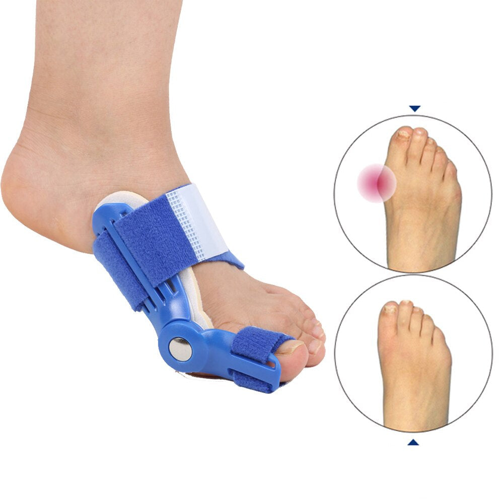 Korrekciós sínt a Hallux Valgus-hoz (1 Pár) - BunionFix
