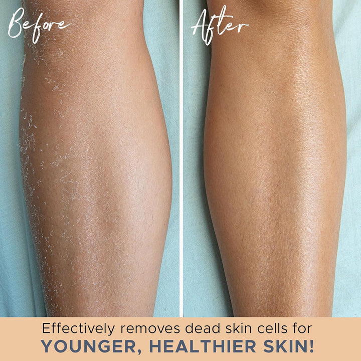 Hámlasztó Fürdőkesztyű - 2 Részes Készlet