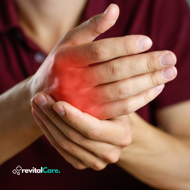 Anti-Artritis Kesztyűk - PainRelief Pro