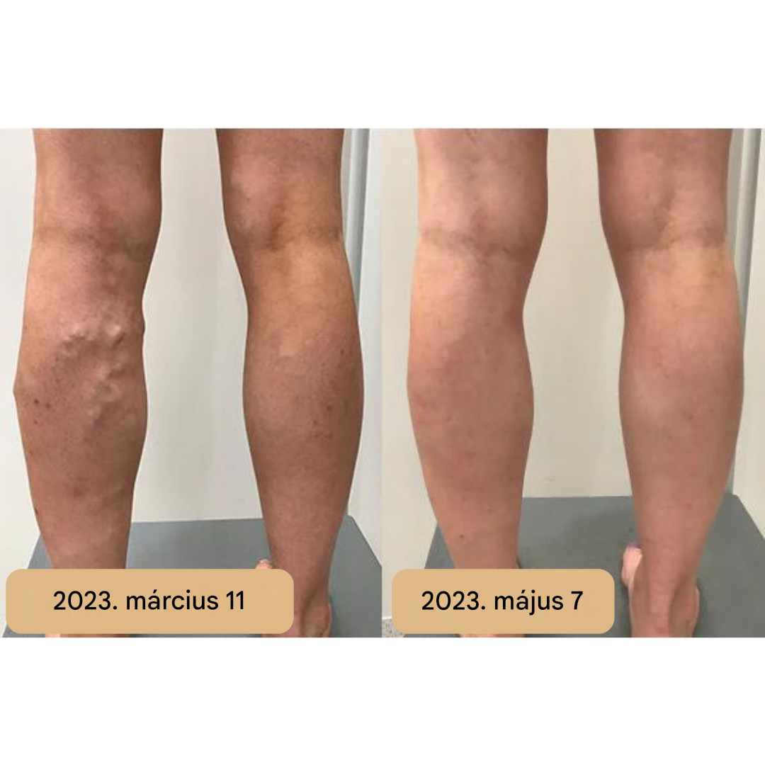 Talpmasszázs Szőnyeg - AkupresszúraÁramlás