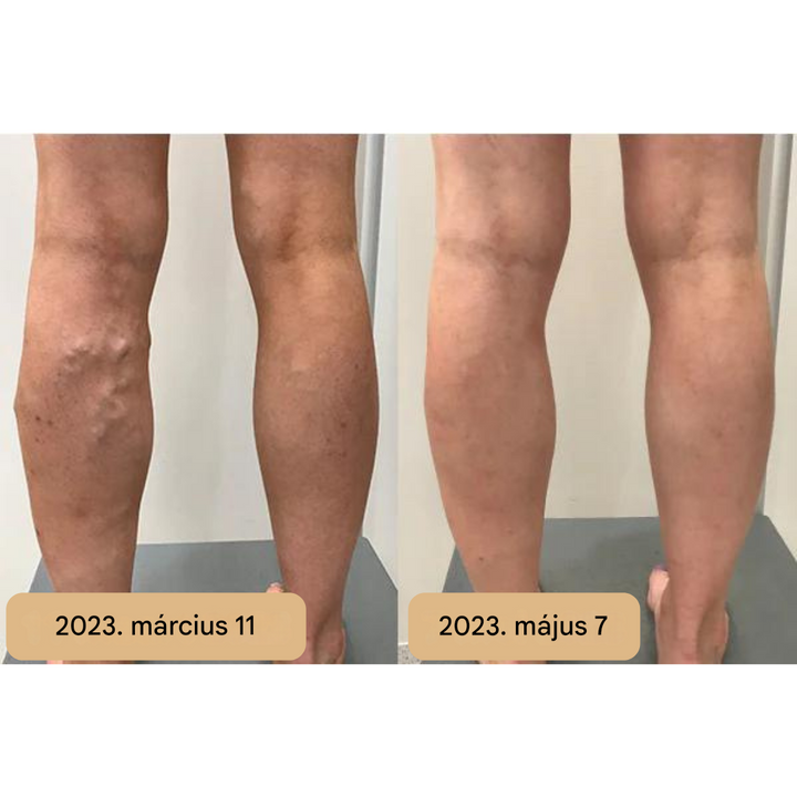 Talpmasszázs Szőnyeg - AkupresszúraÁramlás