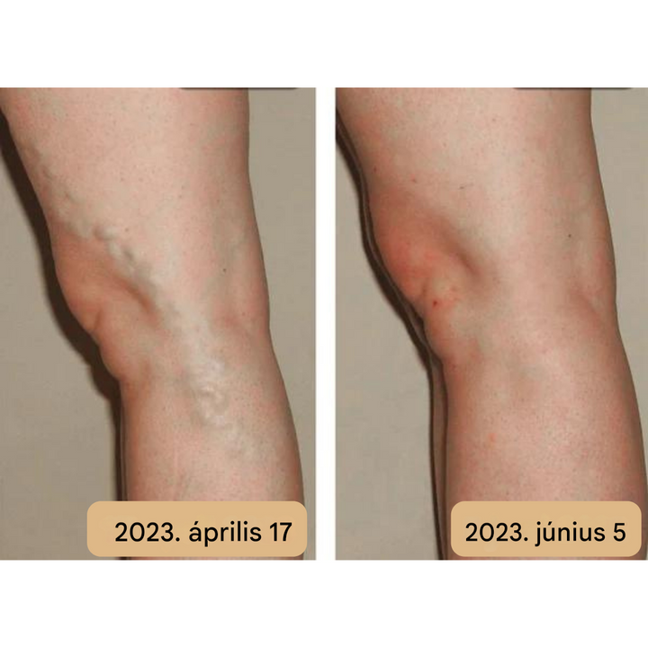 Talpmasszázs Szőnyeg - AkupresszúraÁramlás