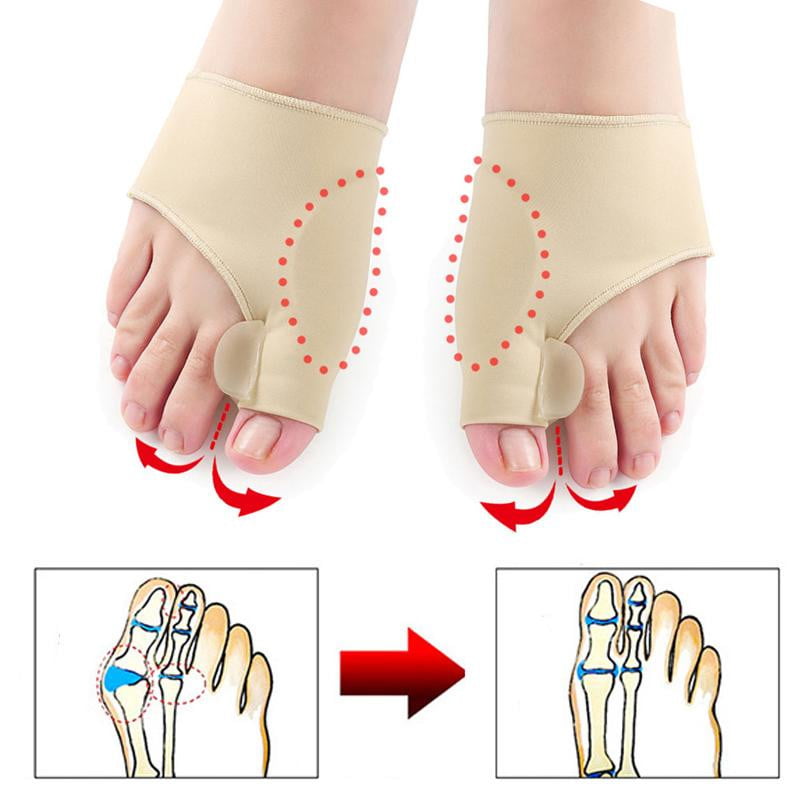 Hallux Valgus Védő (1 pár) - OrthoBunion