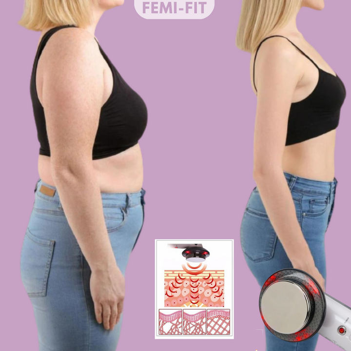 3 az 1-ben Vénás és Cellulit Eltávolító - SlimShape