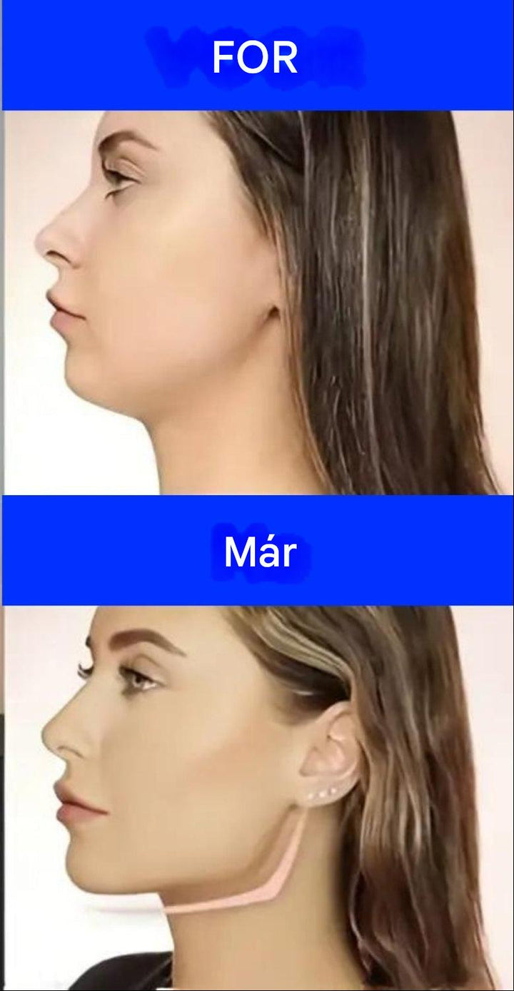 Állkapocs edző - JawSculptor Pro