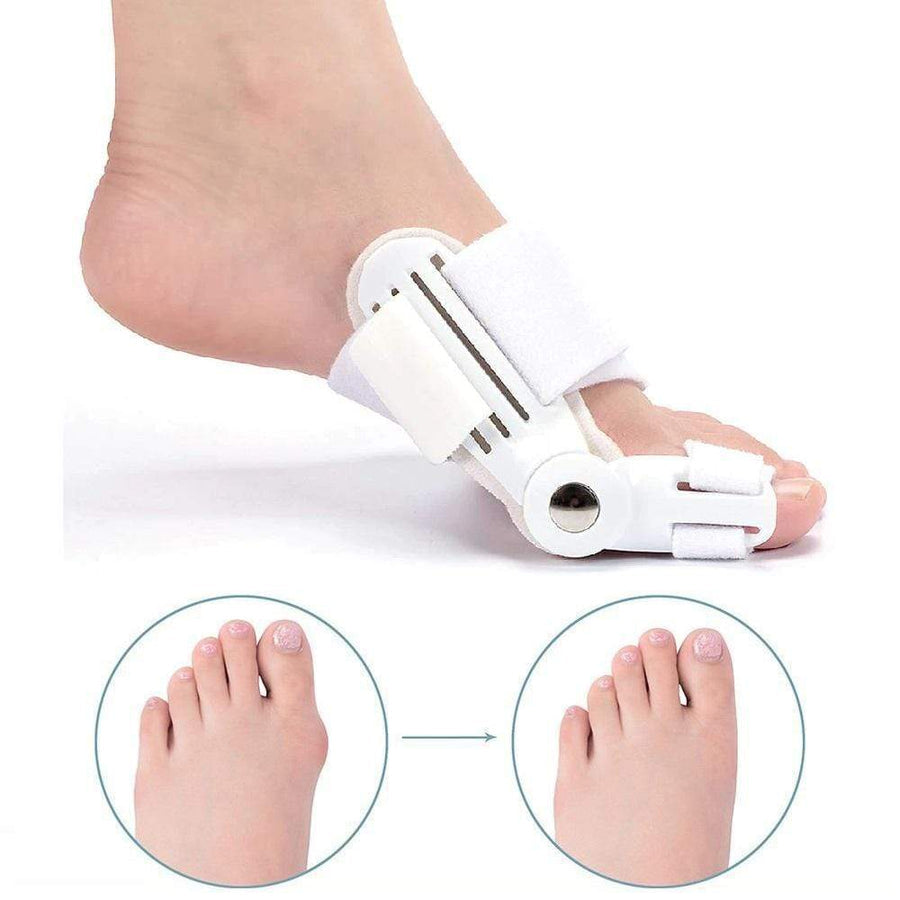 Korrekciós sínt a Hallux Valgus-hoz (1 Pár) - BunionFix