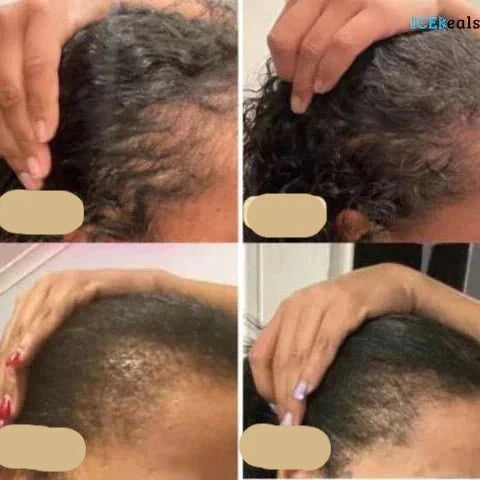 Természetes Haj Növekedési Olaj - PureGrowth